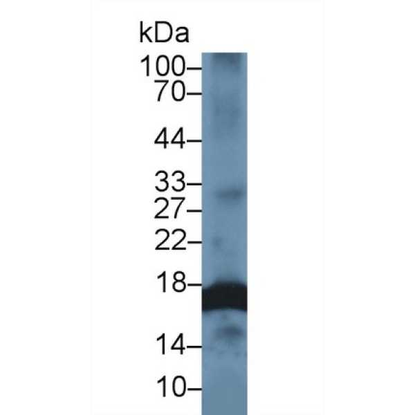 含锌飘带域蛋白1(ZNRD1)多克隆抗体