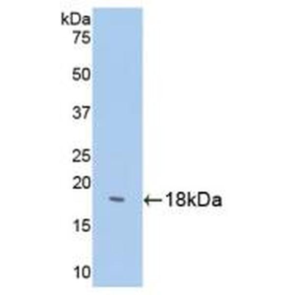 微管关联蛋白1轻链3α(MAP1LC3a)多克隆抗体