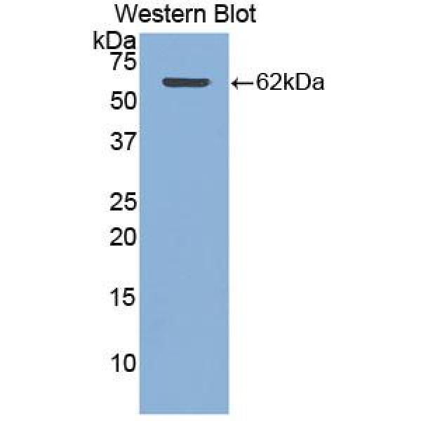 微管蛋白折叠辅酶A(TBCA)多克隆抗体