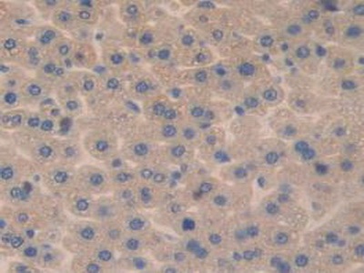 干燥综合征抗原A1(SSA1)多克隆抗体