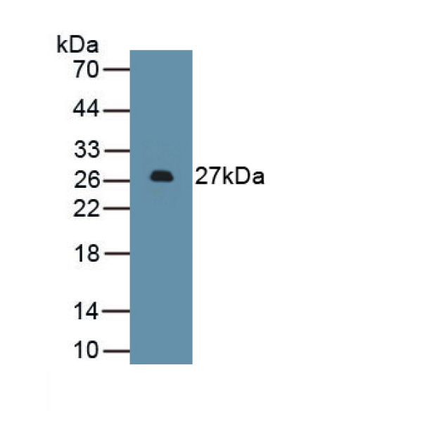 核糖核酸酶Ⅲ(RNASEN)多克隆抗体