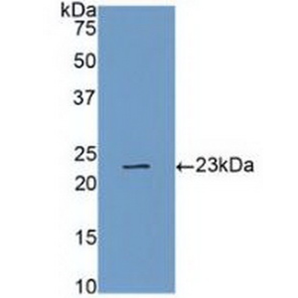 Bcl2修正因子(BMF)多克隆抗体