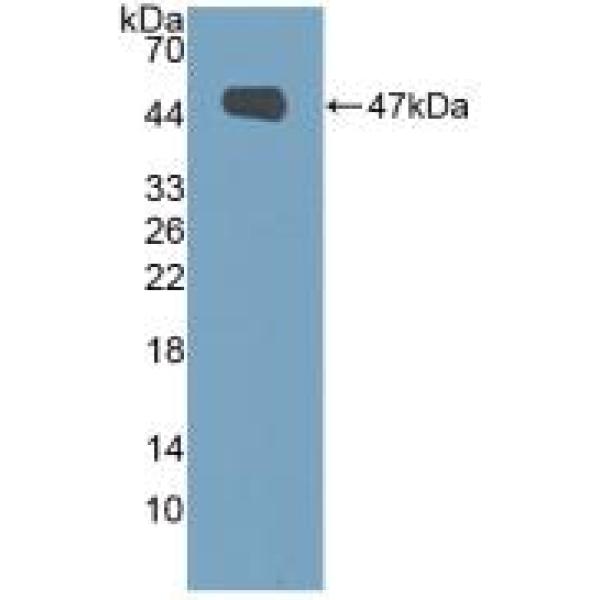 微管关联丝/苏氨酸激酶2(MAST2)多克隆抗体