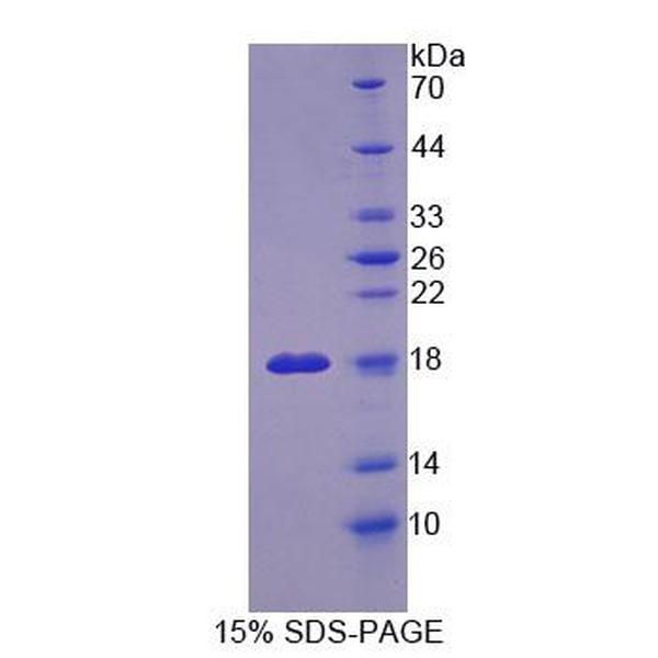 骨症关联跨膜蛋白1(OSTM1)重组蛋白(多属种)