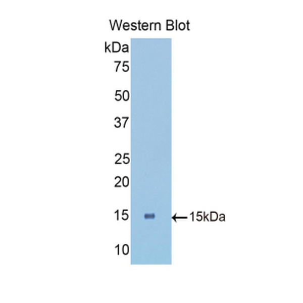 低密度脂蛋白受体相关蛋白关联蛋白1(LRPAP1)多克隆抗体
