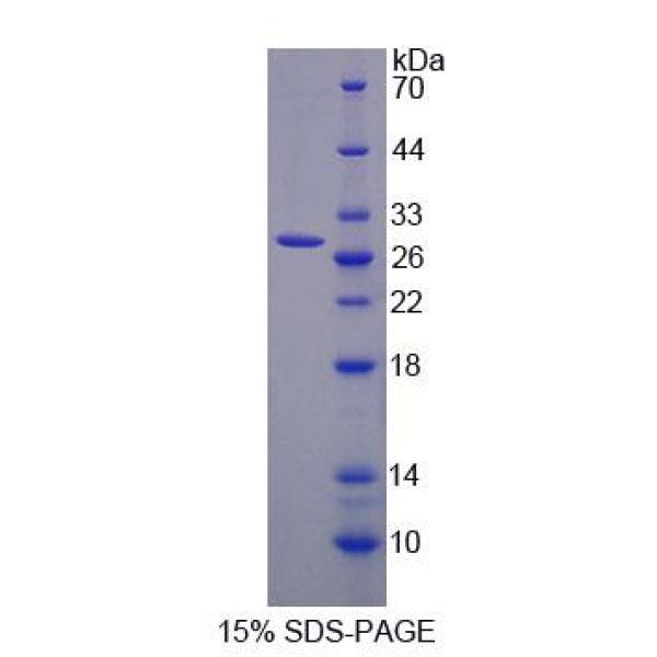 轻肽网格蛋白A(CLTA)重组蛋白(多属种)