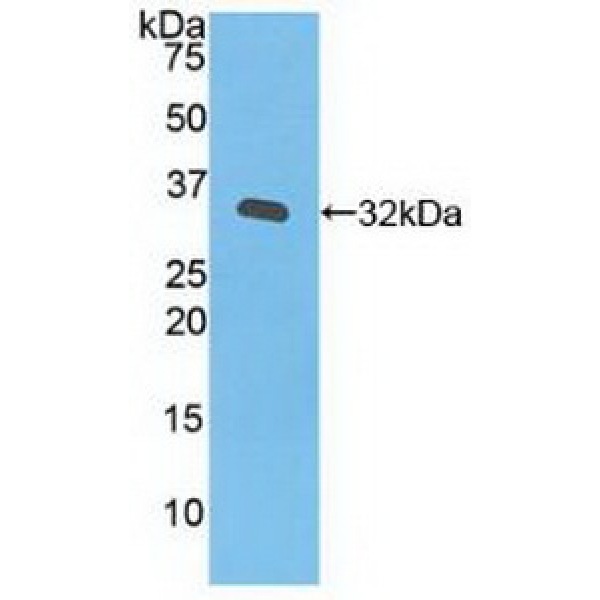 Janus激酶3(JAK3)多克隆抗体