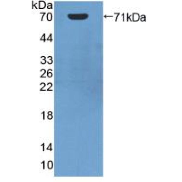 上皮细胞转化序列2(ECT2)多克隆抗体
