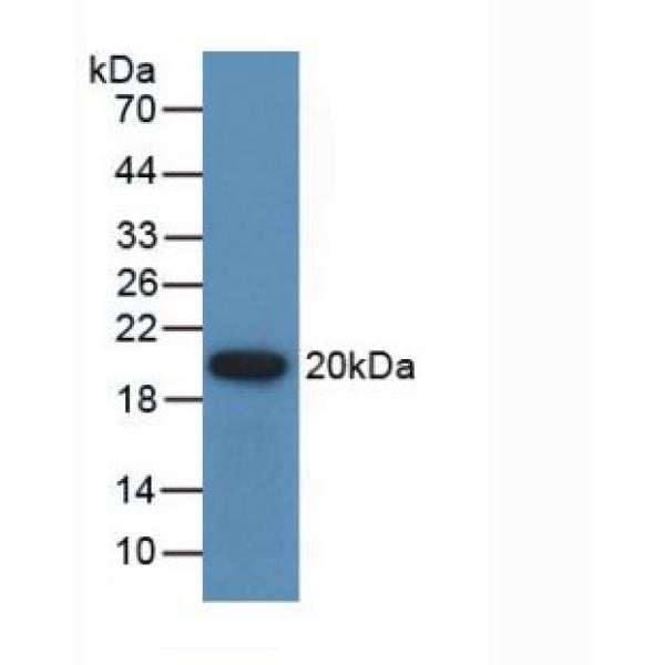 脯氨酸/丝氨酸丰富卷曲螺旋蛋白1(PSRC1)多克隆抗体