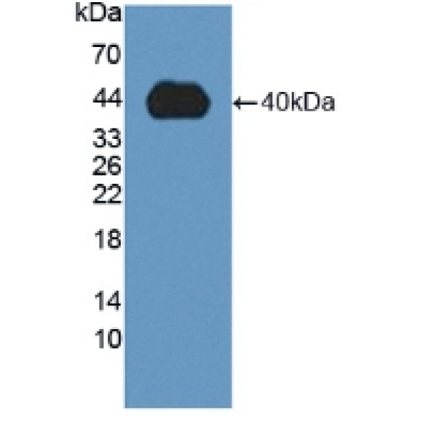 唾液酸乙酰酯酶(SIAE)多克隆抗体