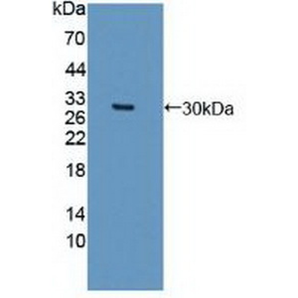 Runt相关转录因子2(RUNX2)多克隆抗体