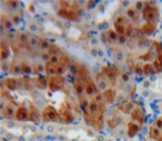 微小染色体维持缺陷蛋白5(MCM5)多克隆抗体