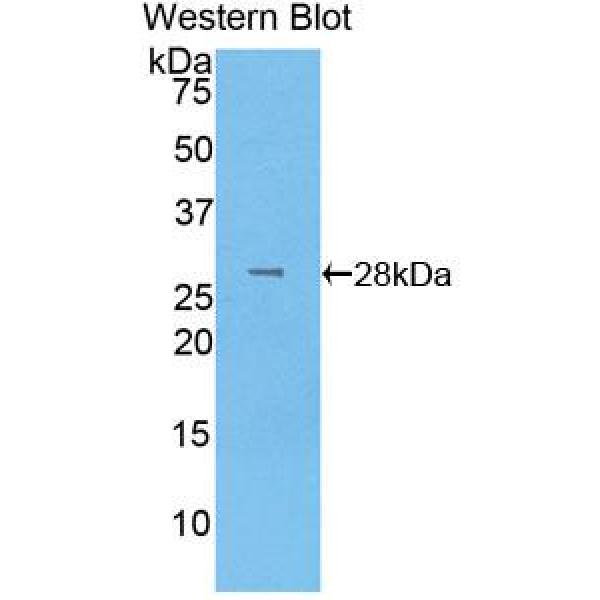 发育全能关联蛋白3(DPPA3)多克隆抗体