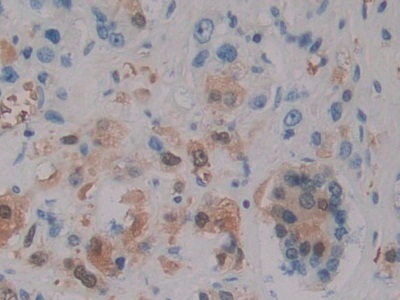 中间&#945;-球蛋白抑制因子H5(ITIH5)多克隆抗体