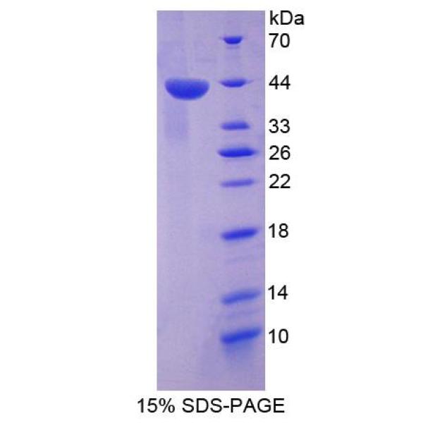 TP53目标基因5(TP53TG5)重组蛋白(多属种)