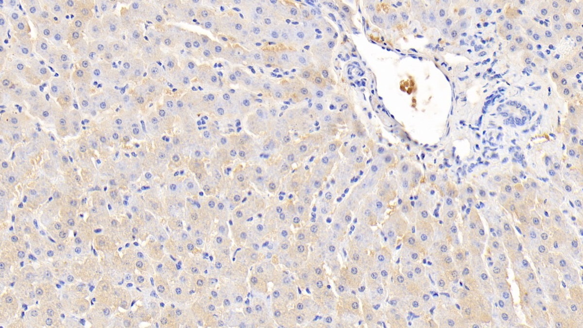 滑行蛋白&#945;(TXLNa)多克隆抗体