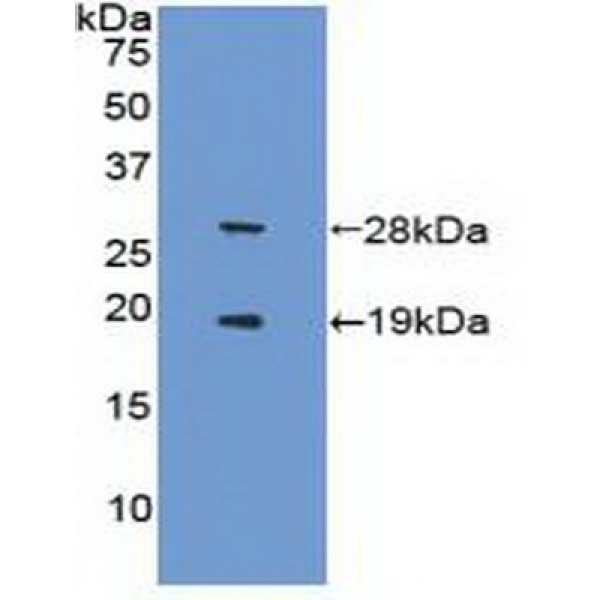 乳腺癌抗雌激素药物耐药性基因3(BCAR3)多克隆抗体