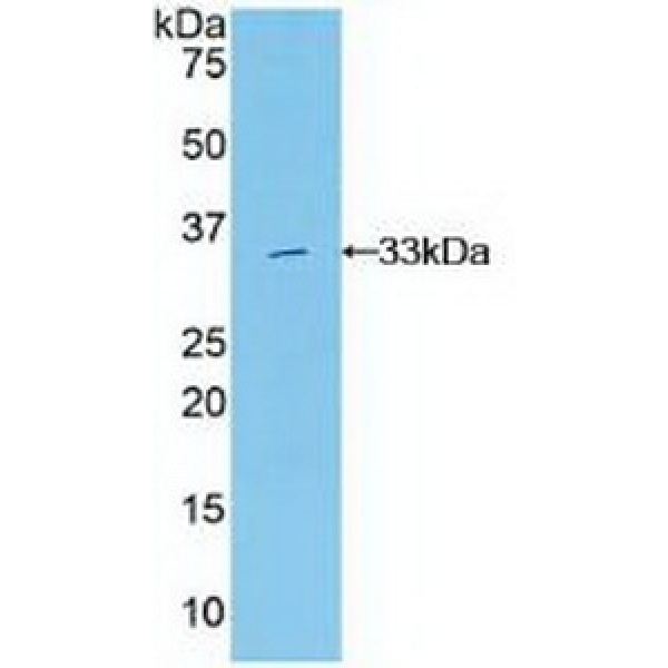 S-期激酶关联蛋白1(SKP1)多克隆抗体