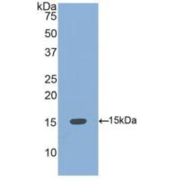 低氧诱导因子1α亚基抑制因子(HIF1aN)多克隆抗体