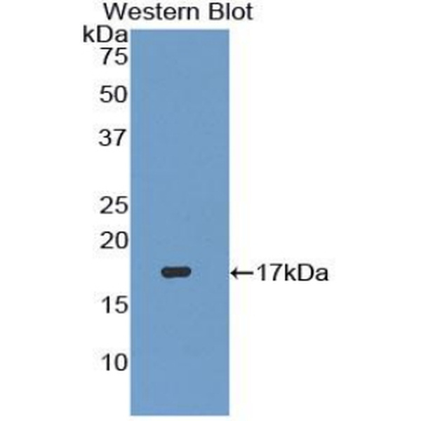 周期素依赖性激酶抑制因子1A(CDKN1A)多克隆抗体