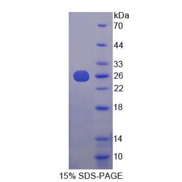 赫曼斯基普德拉克综合征蛋白4(HPS4)重组蛋白(多属种)