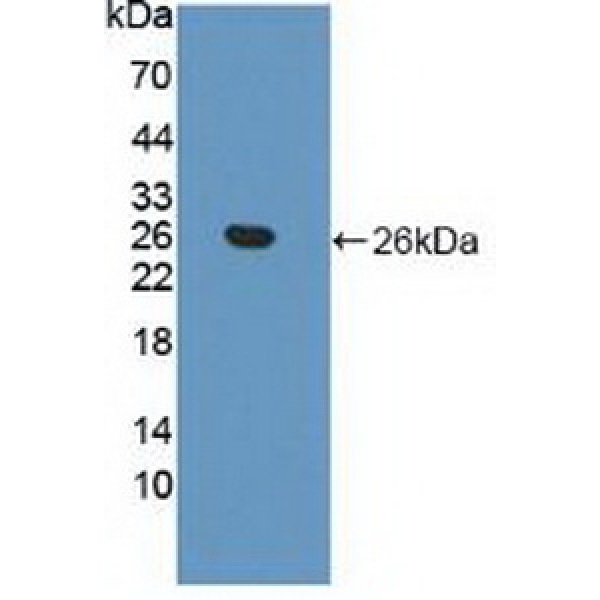 生物素酰胺酶(BTD)多克隆抗体