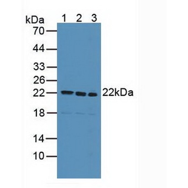 囊泡关联膜蛋白关联蛋白B(VAPB)多克隆抗体