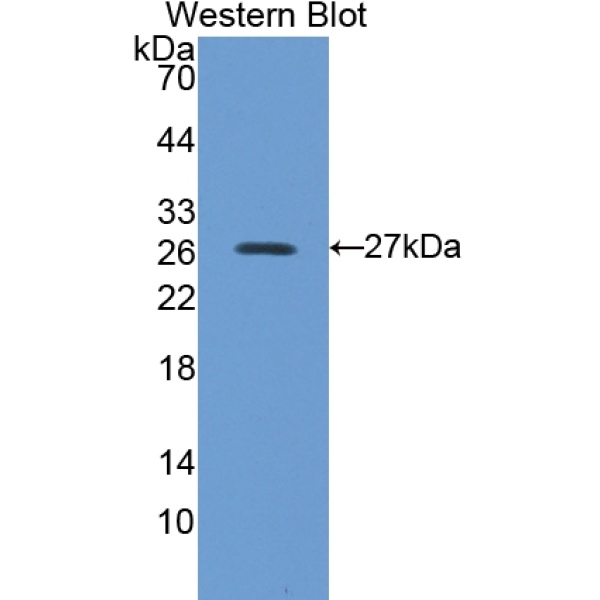 布鲁东氏酪氨酸激酶(Btk)多克隆抗体
