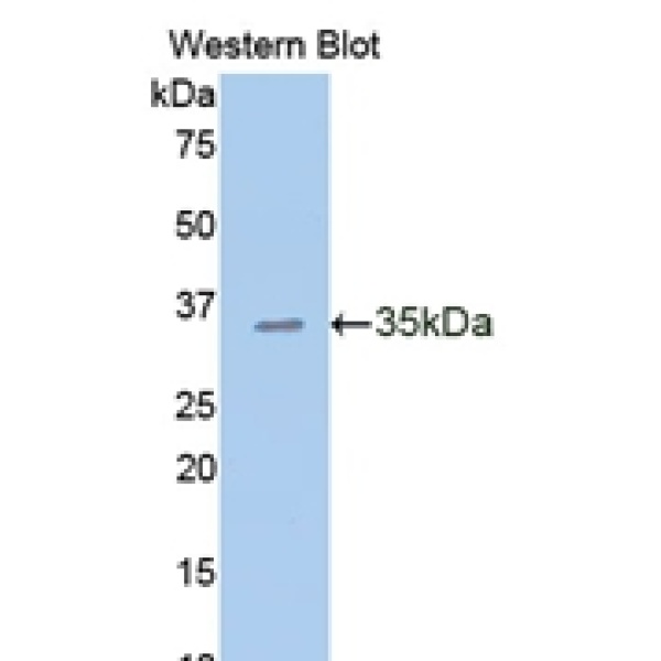 前梯度蛋白2(AGR2)多克隆抗体