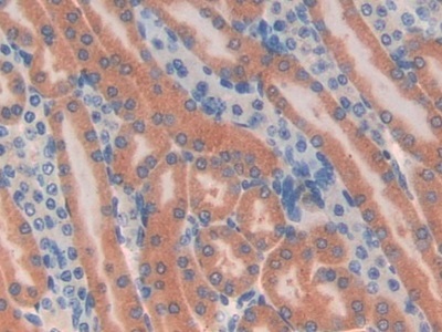 微管蛋白&#948;(TUBd)多克隆抗体