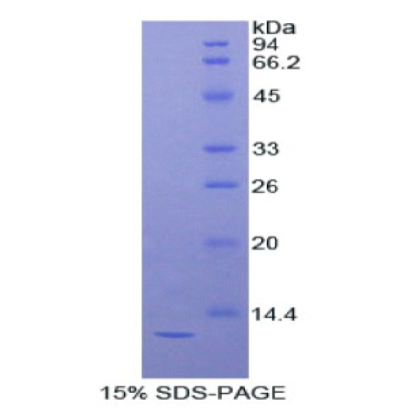 安定结合抑制因子(DBI)重组蛋白(多属种)