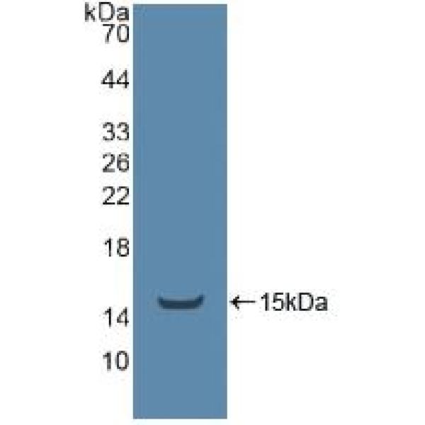 磷脂酰肌醇结合网格蛋白装配蛋白(PICALM)多克隆抗体