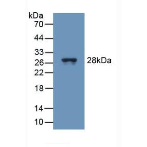 氧化应激诱导生长抑制因子1(OSGIN1)多克隆抗体