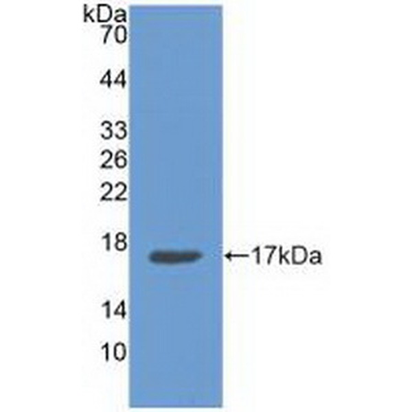 Zeste同源物增强子2(EZH2)多克隆抗体