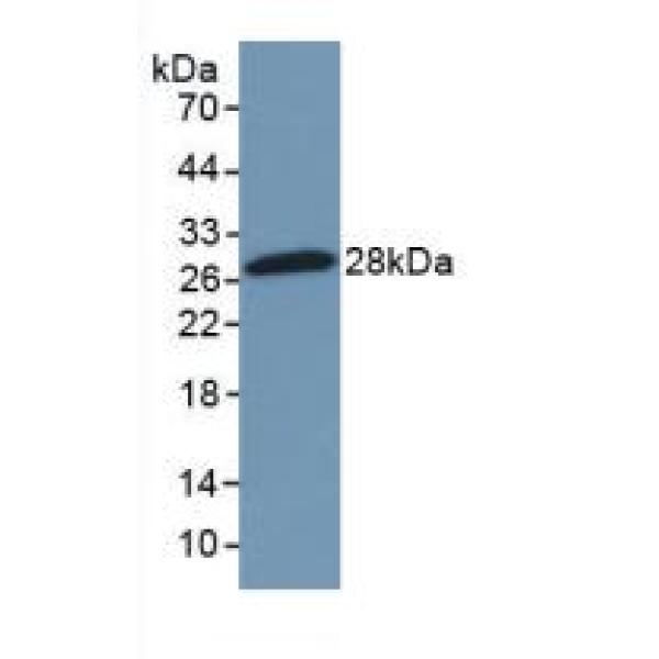 免疫球蛋白A(IgA)多克隆抗体