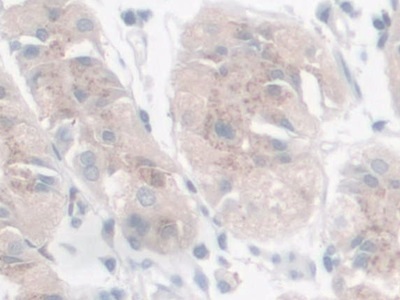 Rho GDP解离抑制因子&#946;(ARHGDIb)多克隆抗体