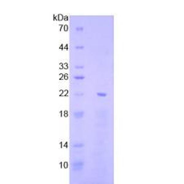 早期生长应答因子1(EGR1)重组蛋白(多属种)