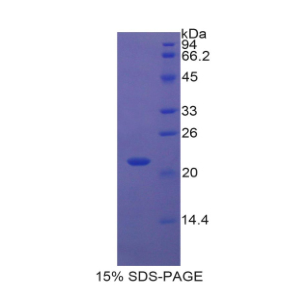 微粒体谷胱甘肽S转移酶1(MGST1)重组蛋白(多属种)