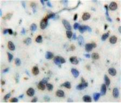 细胞周期素B(CCNB)多克隆抗体