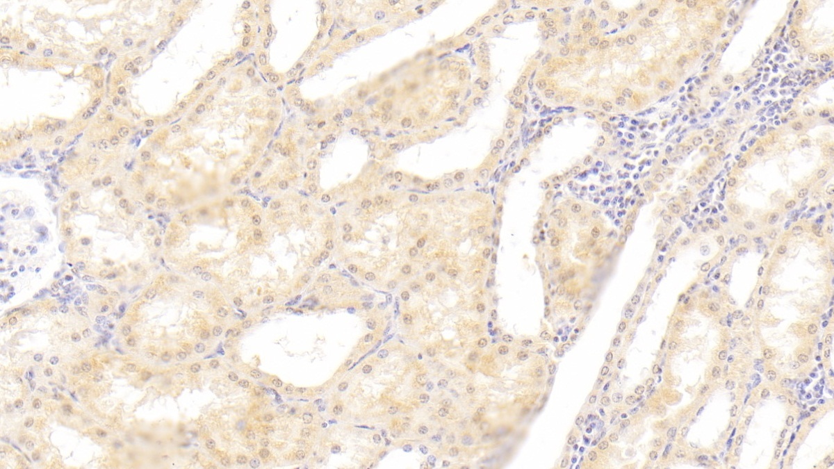 跨膜4域亚家族A成员1(CD20)多克隆抗体