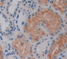 肾母细胞瘤过表达基因(NOV)多克隆抗体