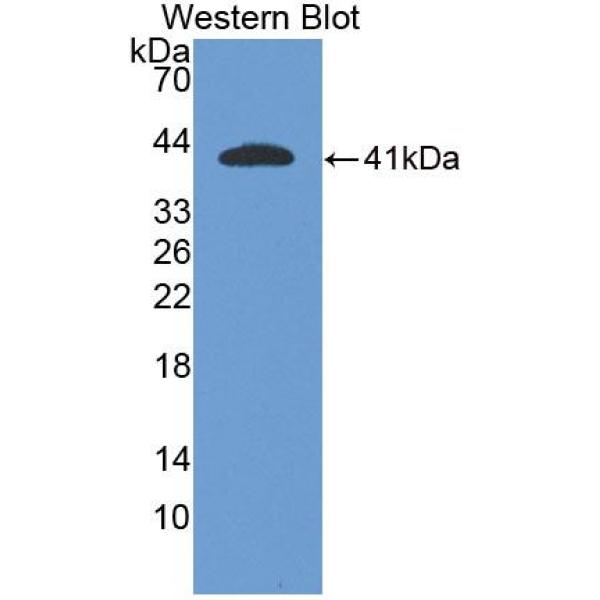 密度增强磷酸酶1(DEP1)多克隆抗体