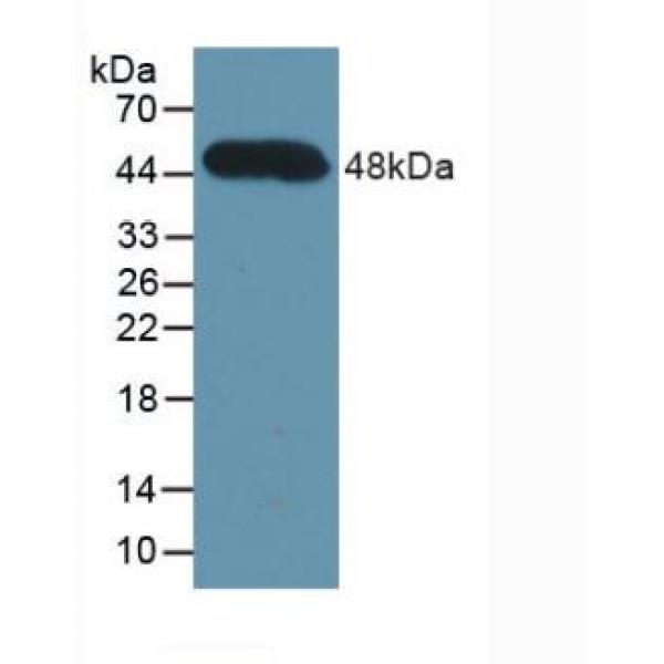 可溶性半乳糖凝集素3结合蛋白(LGALS3BP)多克隆抗体