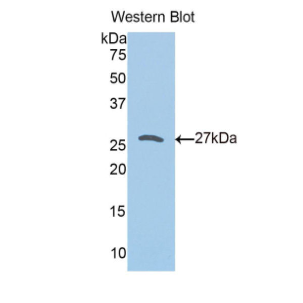 非受体型蛋白酪氨酸磷酸酶14(PTPN14)多克隆抗体