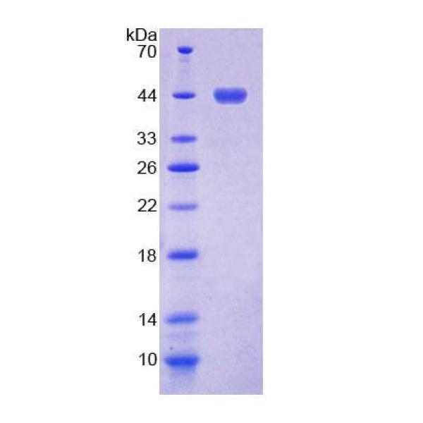 干燥综合征抗原A2(SSA2)重组蛋白(多属种)