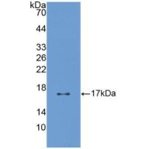 桥粒芯胶粘蛋白3(DSC3)多克隆抗体