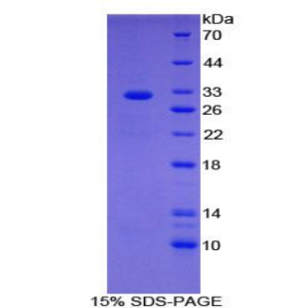 细胞死亡诱导DFFA样效应蛋白C(CIDEC)重组蛋白(多属种)