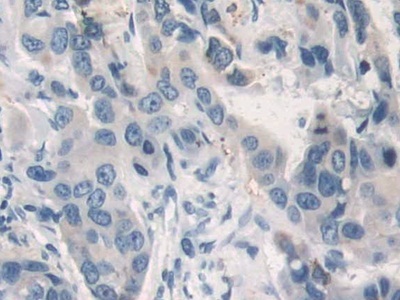 乳腺癌抗雌激素药物耐药性基因3(BCAR3)多克隆抗体