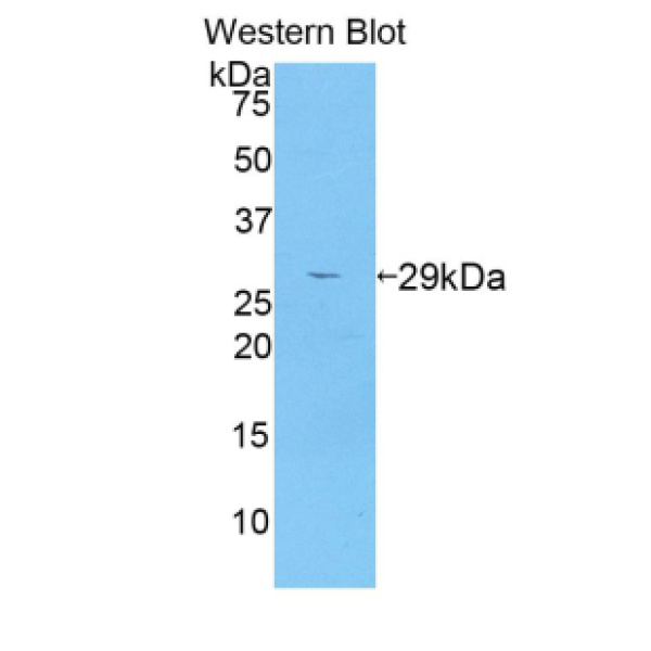 真核翻译起始因子2亚基1(EIF2S1)多克隆抗体