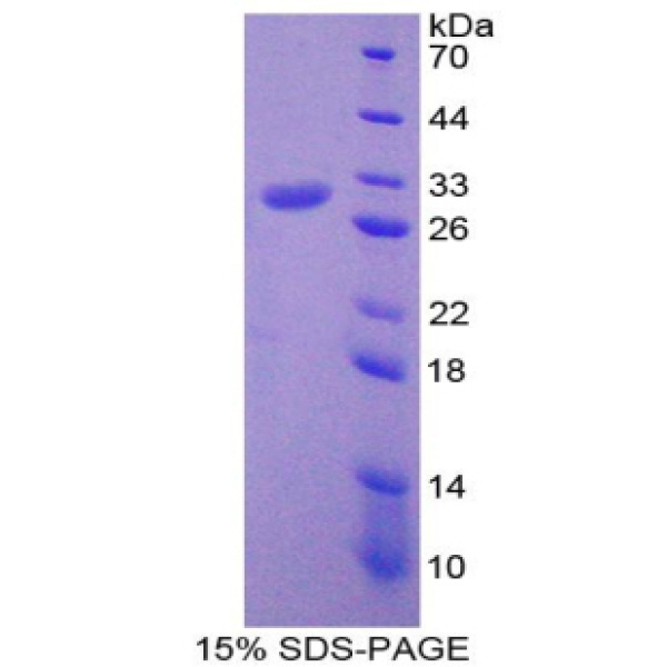 细胞程序性死亡蛋白6相互作用蛋白(PDCD6IP)重组蛋白(多属种)